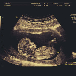 国产伦子伦视频免费播放
